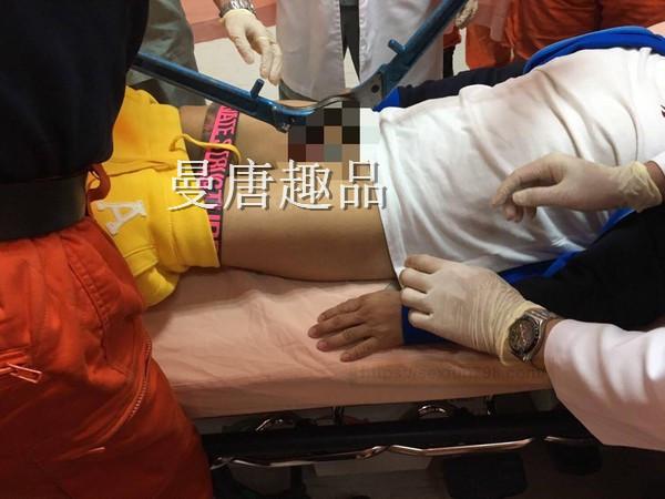 断4支破坏剪!阴茎套金属环卡死 消防拿出油压剪笑了